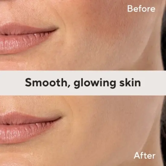 Finishing Touch Flawless Dermaplane Facial Exfoliator and Hair Remover for Women - 6ct image {7}