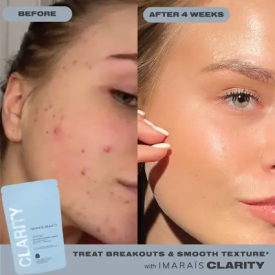 Imarais Beauty Clarity Anti-Blemish Gummies for Clear Complexion - Vegan and Sugar-Free - 30ct image {5}