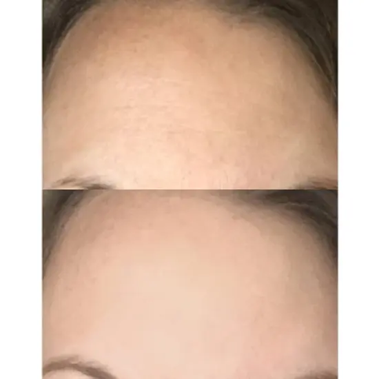 derma e Pure Biome Moisturizing Eye Cream - 0.5 fl oz image {5}