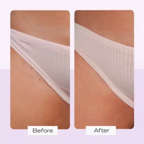 FIRST AID BEAUTY Ingrown Hair Pads - 60ct - Ulta Beauty image {5}