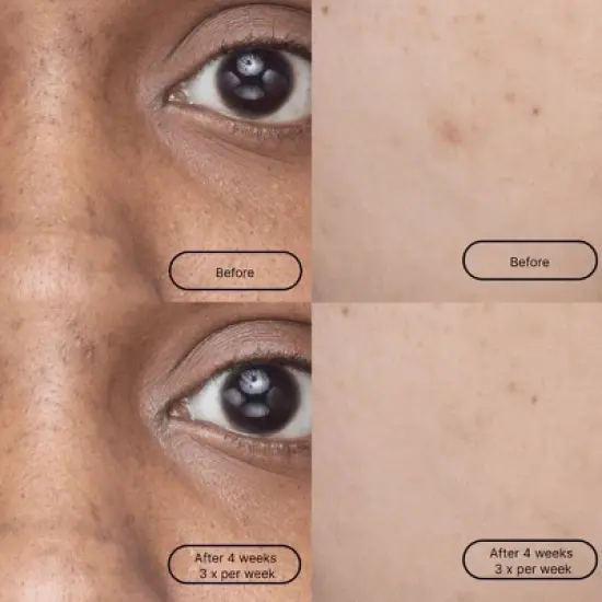 LOOPS Hyper Smooth Dark Spot Treatment Hydrogel Face Mask - 0.19oz image {4}