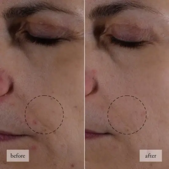 philosophy Hope In A Jar Mini Set - 3pc - Ulta Beauty image {8}