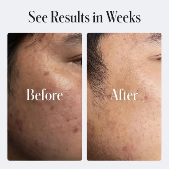 Geologie Clear System Skin Repair Moisturizer - 0.2% Retinol - 2 fl oz image {4}