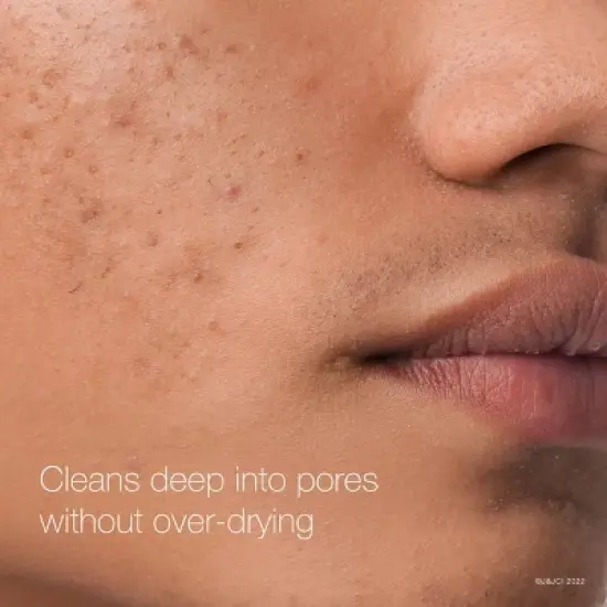 Neutrogena Rapid Clear Maximum Strength Acne Face Pads for Acne-Prone Skin - 60 ct image {4}