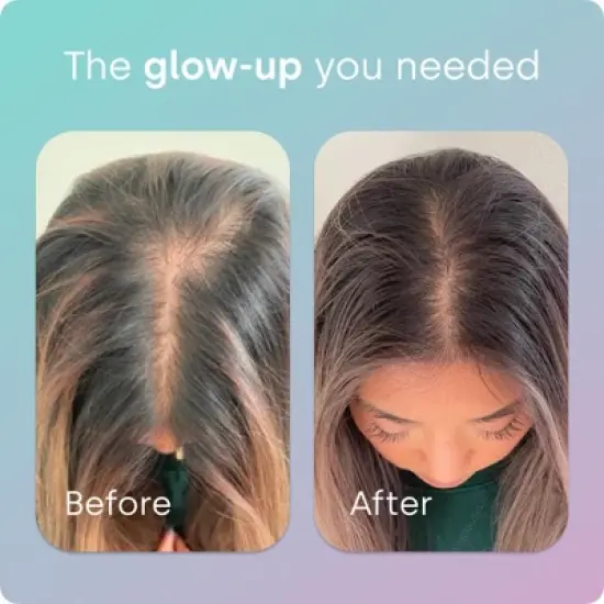 Biosil Advanced Hair + Nail Care - Grow, Strengthen & Thicken Hair and Nails - with Patented ch-OSA & Biotin image {3}