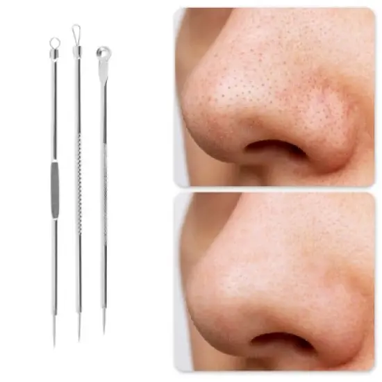 Unique Bargains Portable Straight Clip Pimple Extractor Tool Kit Silver Tone 1 Set image {4}