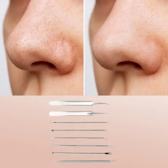 Unique Bargains Facial Pimple Extractor Tool Kit Silver Tone Set of 8 image {4}