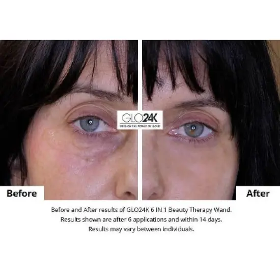 GLO24K 6-in-1 Beauty Therapy Wand for Face Eyes and Neck image {6}