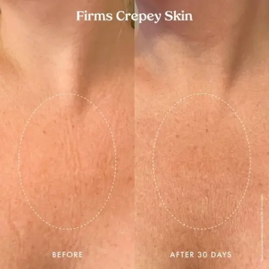 Kopari Ultra Renewal Retinol Body Cream - 4.7 fl oz - Ulta Beauty image {8}