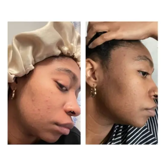 ROSEN Skincare Tropics Toner for Texture and Scarring - 4.3 fl oz image {4}