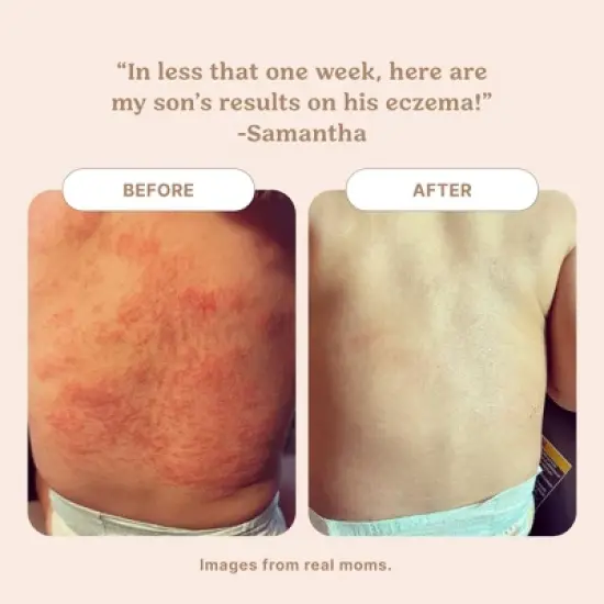 Roe Wellness Biome Barrier Cream for Baby- 4oz image {5}
