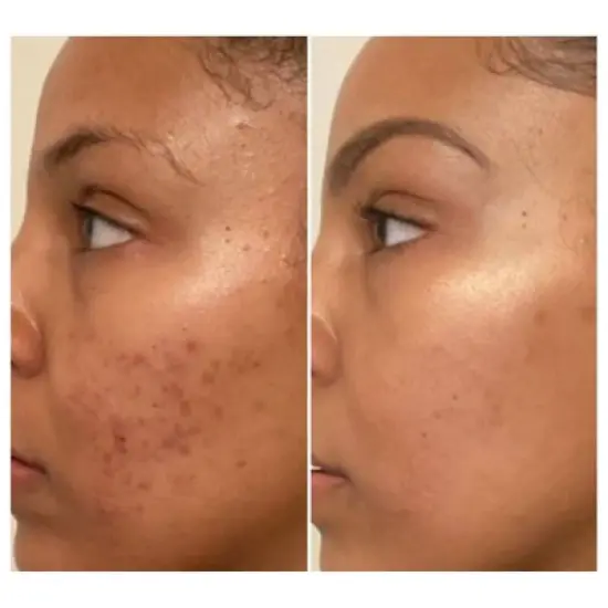 Urban Skin Rx Deck the Dark Spots Exfoliate + Retinol + Hydrate 3-Step System Skincare Gift Set - 3pc image {5}