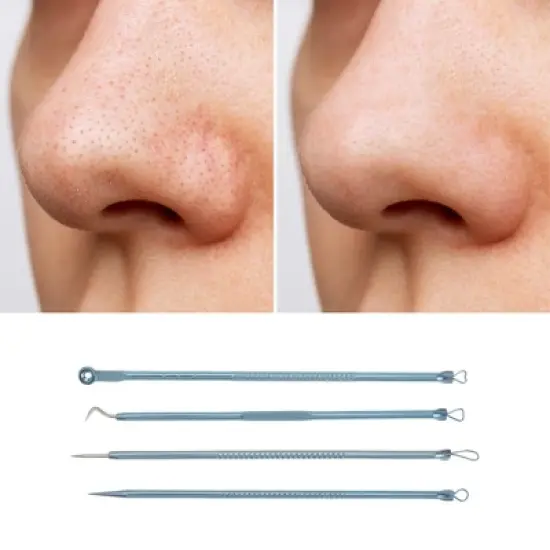 Unique Bargains Heart Facial Pimple Extractor Kit 1 Set image {4}