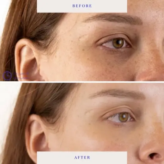 BioRepublic SkinCare Lost Baggage Under Eye Masks - 3pk image {2}