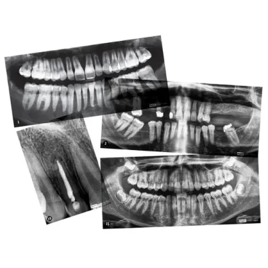 Roylco Dental X-Rays image {2}