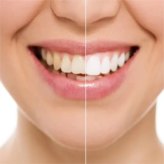 Rembrandt Deeply White & Peroxide Whitening Toothpaste - Peppermint image {5}