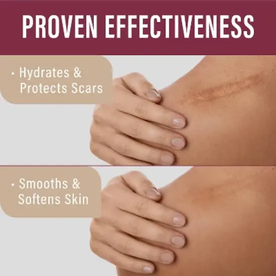 Nuvadermis Scar Gel for Surgical Scars - 1oz image {3}
