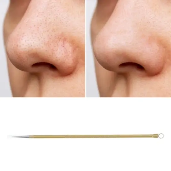 Unique Bargains Reusable Double Headed Pimple Extractor 1 Pc image {4}