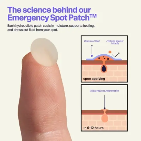 Curology Emergency Spot Facial Pimple Patches image {9}