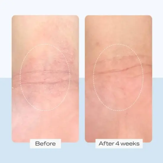 FIRST AID BEAUTY Women's Sensitive Skin Starter Kit, Cleanse, Exfoliate and Hydrate - 3pc - Ulta Beauty image {7}