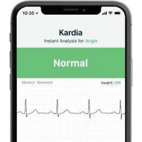 KardiaMobile FDA Cleared Personal EKG Monitor image {3}