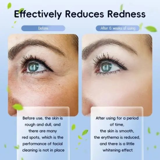 FAAYFIAN Disposable Face Towels XL Face Towelettes Disposable 30 Counts image {6}