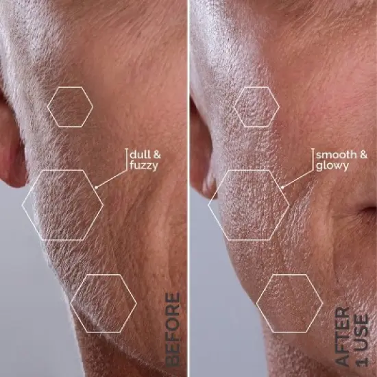 Spa Sciences SIMA Deluxe Sonic Dermaplaning Tool for Exfoliation & Peach Fuzz Removal image {4}