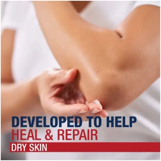 Aquaphor Healing Ointment for Dry, Cracked or Irritated Skin - 1.75oz image {7}