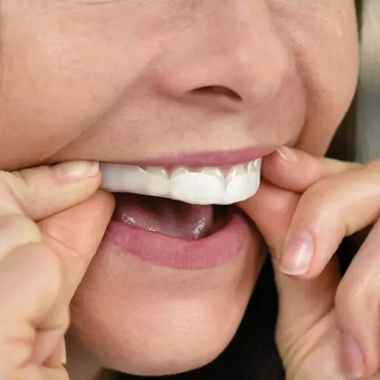 SleepRight ProRx Dental Guard &ndash; Moldable Mouth Guard for Teeth Grinding, Clenching, and Bruxism &ndash; Ultra-Thin, Custom-Fit, Durable and Comfortable image {4}