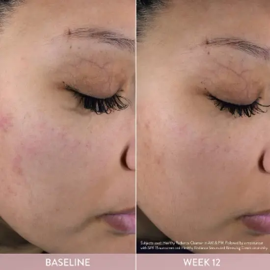 Cetaphil Healthy Radiance Brightening Renewing Cream - 1.7oz image {1}