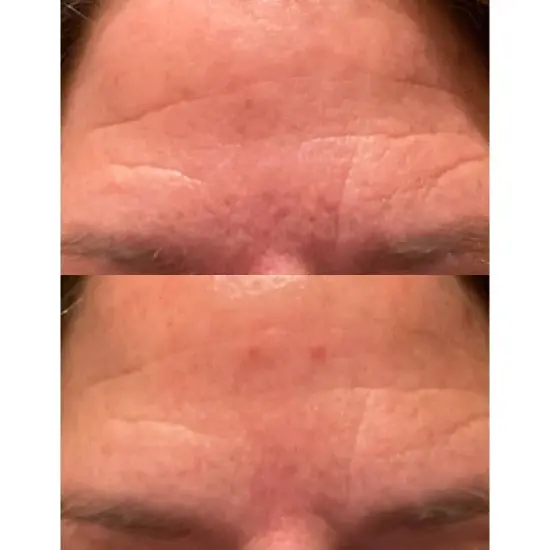 derma e Stem Cell Eye Lifting Treatment &ndash; 0.5 oz image {5}