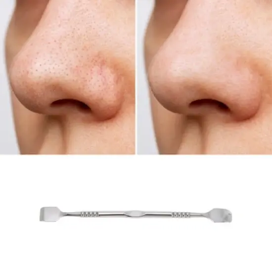 Unique Bargains Durable Facial Pimple Extractor Silver Tone 1 Pc image {4}