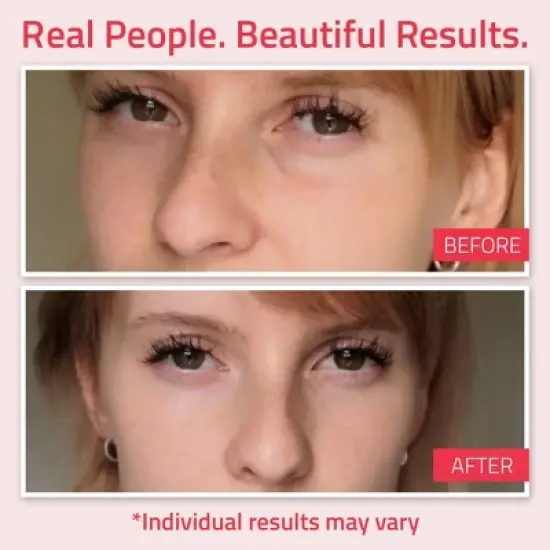 YEOUTH Retinol Eye Cream with Hyaluronic Acid and Tripeptides &ndash; 0.5 oz image {2}