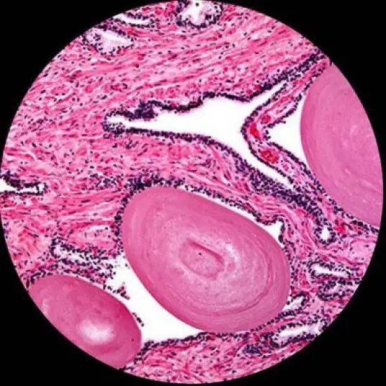 Portable 40X-1000X Magnification Monocular Student Microscope with 25pc Prepared Slide Kit - AmScope image {5}