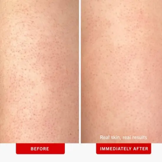 FIRST AID BEAUTY Exfoliating Body Scrub for Sensitive to Normal Skin - Ulta Beauty image {2}