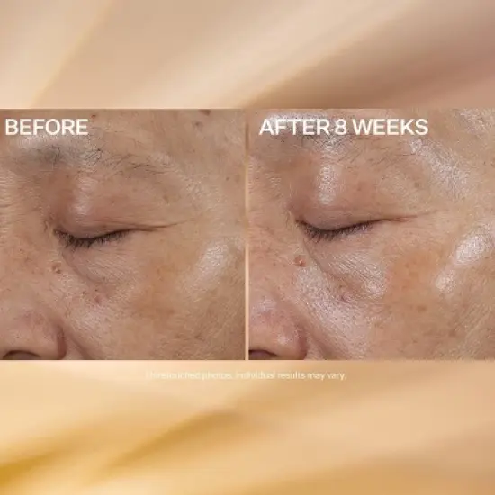 StriVectin Eye Treatment with Vitamin C - 0.5 fl oz - Ulta Beauty image {6}