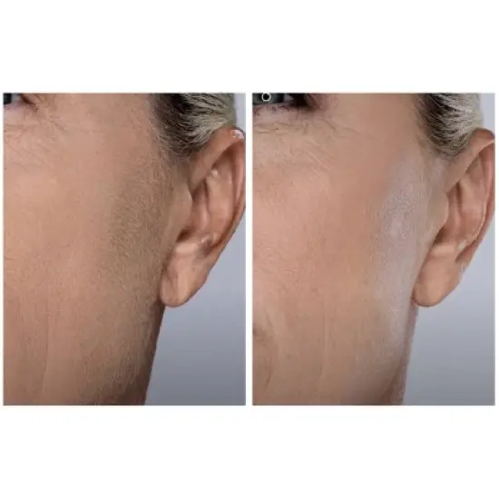 Spa Sciences SIMA Deluxe Sonic Dermaplaning Tool for Exfoliation & Peach Fuzz Removal image {6}