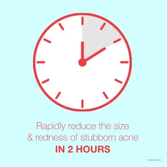 Neutrogena Rapid Clear Stubborn Acne Spot Treatment Gel with Maximum Strength for Acne Prone Skin - 1 oz image {4}