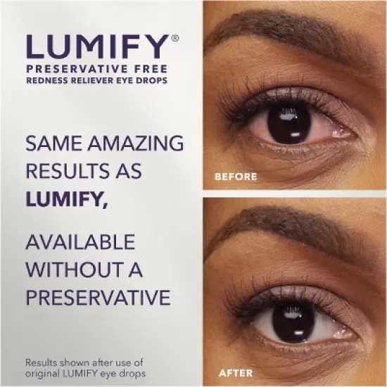 Lumify Eye Drops for Redness Relief - Preservative Free - 8ml/20ct image {2}