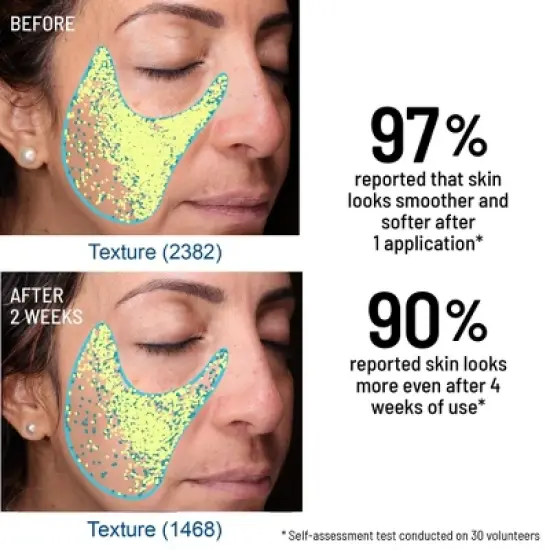 Dr. Brandt Advanced Microdermabrasion Face Exfoliator - Refines Texture, Minimizes the Look of Fine Lines & Enhances Overall Skin Tone image {5}