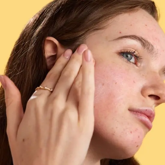 ZitSticka Megashade Breakout-Proof Face Serum - SPF 50 - 1oz image {6}