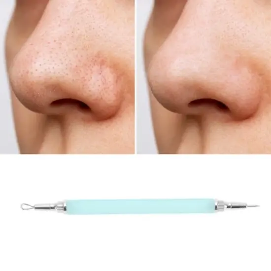 Unique Bargains Dual-Ended Pimple Extractor 7.08" 1 Pc image {4}