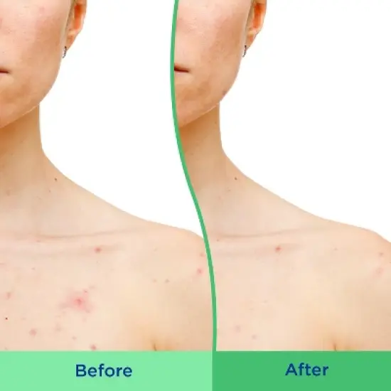 Differin Daily Acne Body Scrub with Salicylic Acid - Scented - 8 fl oz​ image {5}