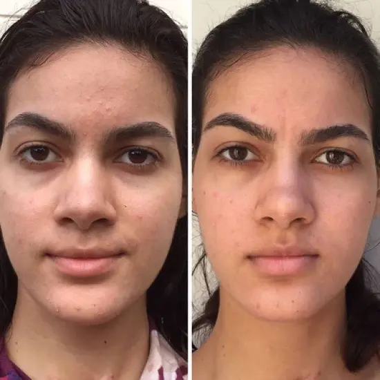 ZitSticka Pore Vac Clearing Clay Face Mask - 2.03 fl oz image {8}