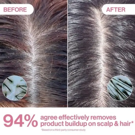 Rizos Curls Apple Cider Vinegar Scalp & Hair Rinse - 10 fl oz image {6}