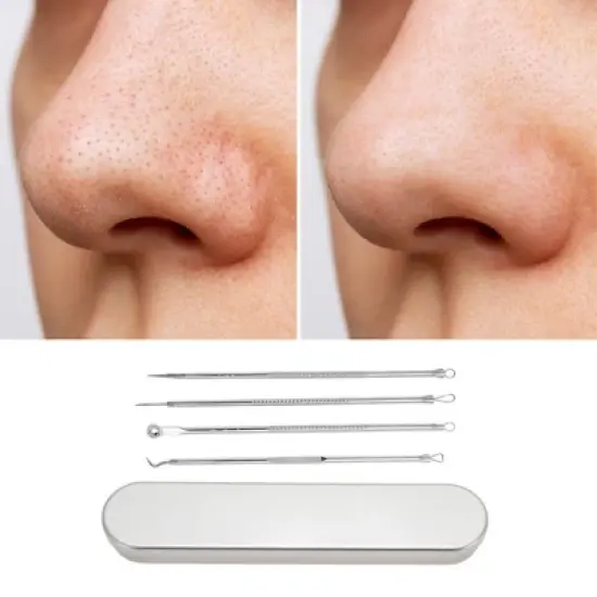 Unique Bargains Four Needles Pimple Extractor Tool Set 6.88"x1.37" Silver Tone 1 Set image {4}