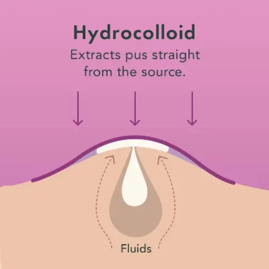 Rael Beauty Miracle Pimple Patch Overnight Spot Cover for Acne image {4}