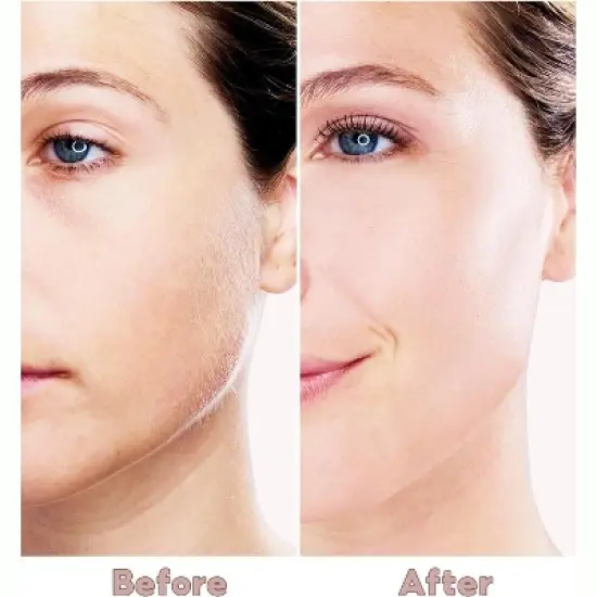 YEVYO Painless Facial Hair Removal for Women, Hair Removal Device for Face, Upper Lips and Chin, USB Rechargeable - White image {4}