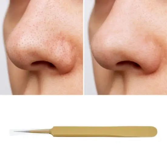 Unique Bargains Convenient Double Headed Pimple Extractor 1 Pc image {4}