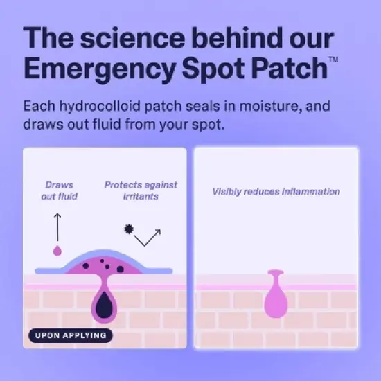 Curology Emergency Spot Facial Pimple Patches image {3}